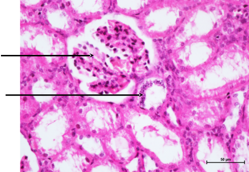 JG Complex 1